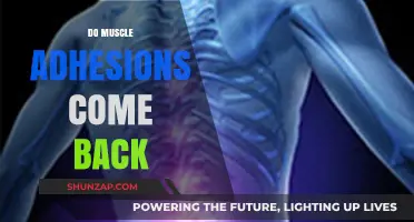 Understanding Muscle Adhesions: Can They Return After Treatment?