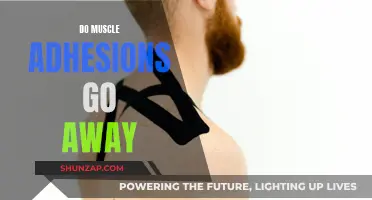 Muscle Adhesions: Can They Heal and Go Away?