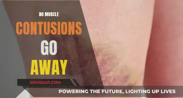 Muscle Contusions: Healing and Recovery Process Explained