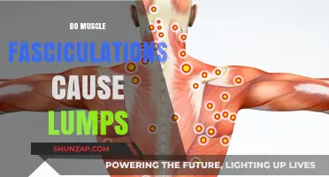 Muscle Fasciculations: Can They Cause Lumps?