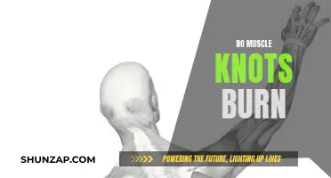 Muscle Knots: Burning Sensation and Treatment Options