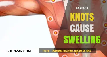 Muscle Knots: Can They Cause Swelling?