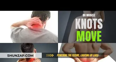 Unraveling the Mystery of Muscle Knots' Migration