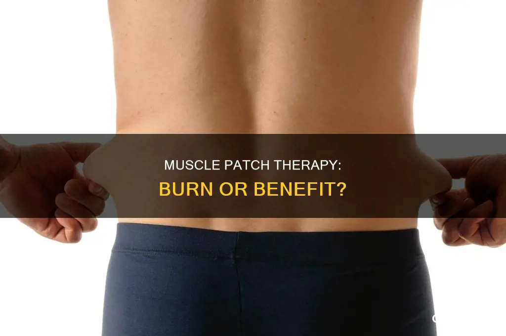 do muscle patches burn