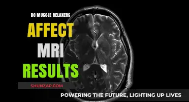 Muscle Relaxers and MRI: Impact on Imaging Results Explained