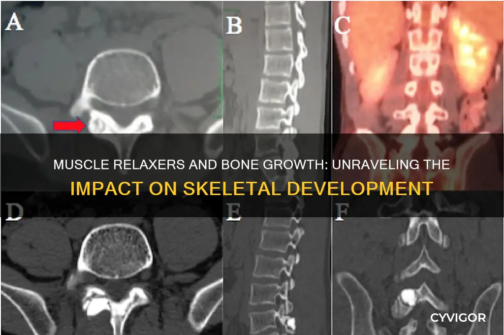 do muscle relaxers inhibit bone growth