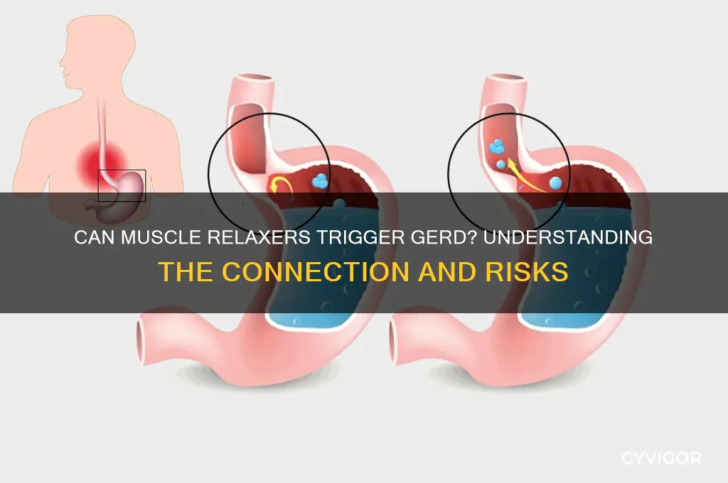 do muscle relaxers produce gerd