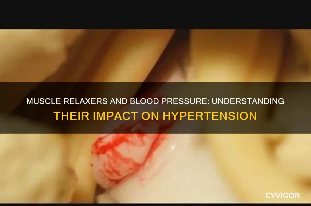 do muscle relaxers reduce blood pressure