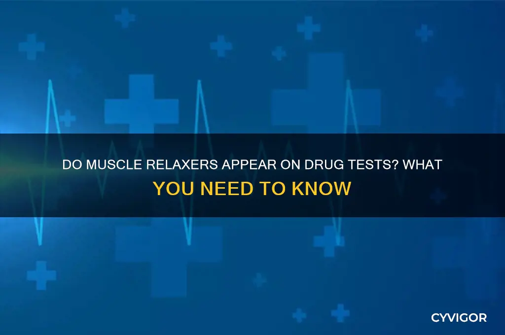do muscle relaxers show on a drug screen