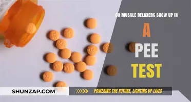 Do Muscle Relaxers Appear in Urine Tests? What You Need to Know