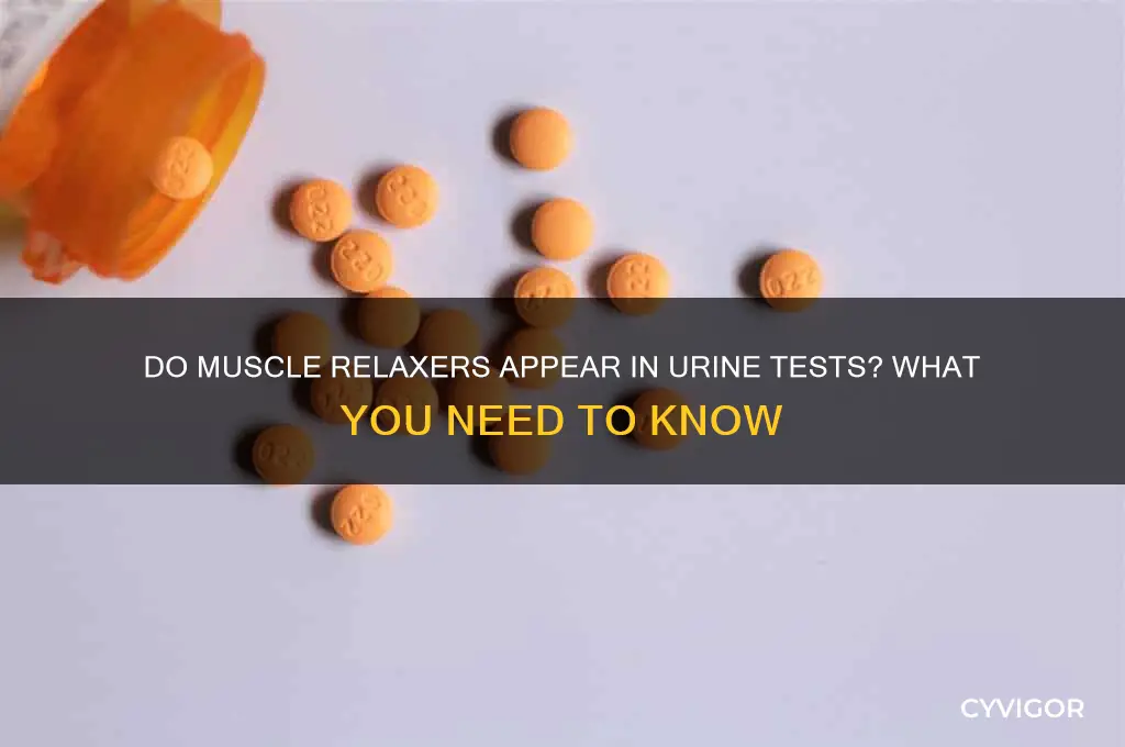 do muscle relaxers show up in a pee test