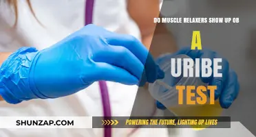 Do Muscle Relaxers Appear on Urine Tests? Facts You Need to Know