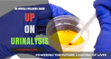 Do Muscle Relaxers Appear in Urine Tests? Facts You Need to Know