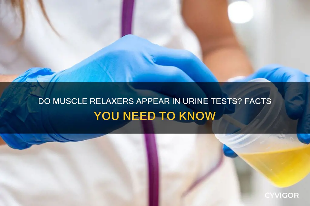 do muscle relaxers show up on urinalysis