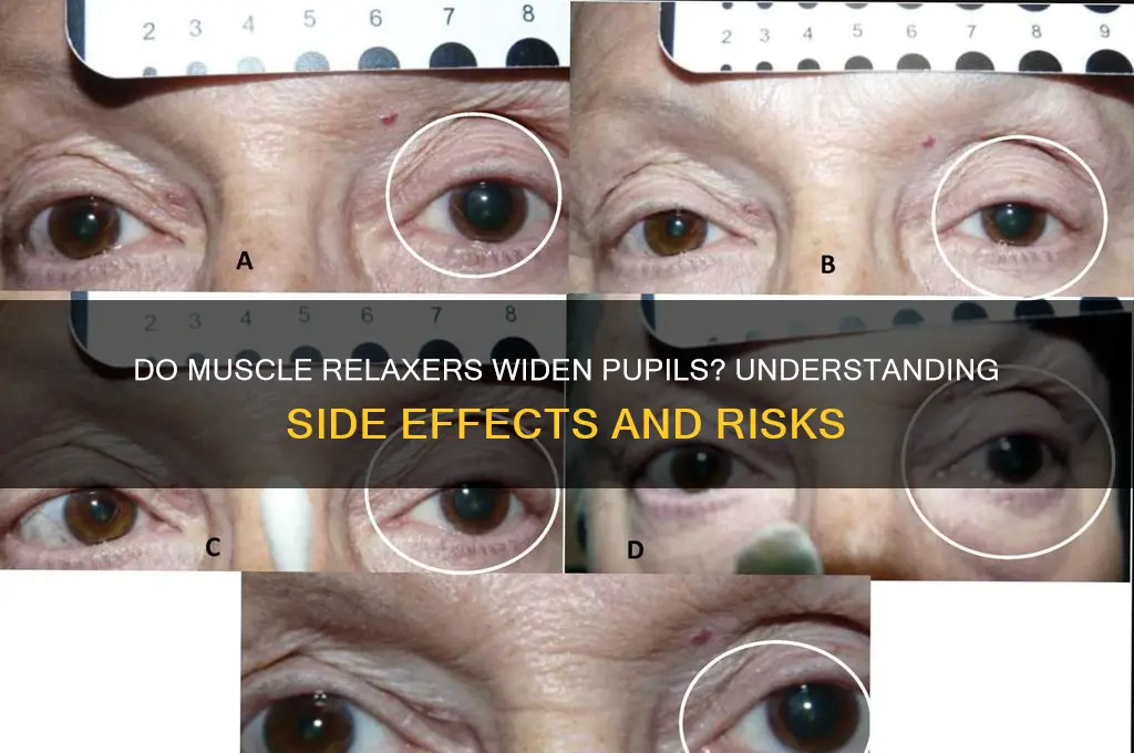 do muscle relaxers widen pupil