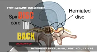 Do Muscle Relaxers Effectively Treat Slipped Disc Back Pain?