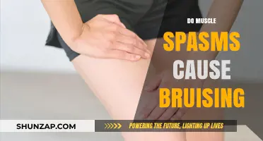 Muscle Spasms: Can They Cause Bruising?