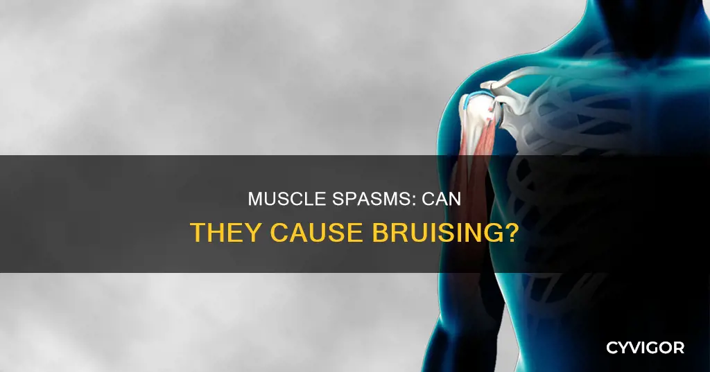 do muscle spasms cause bruising