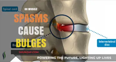 Muscle Spasms and Bulges: What's the Connection?