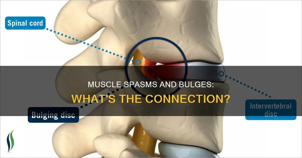 do muscle spasms cause bulges