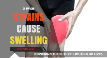 Muscle Strains: Swelling, Causes, and Treatment