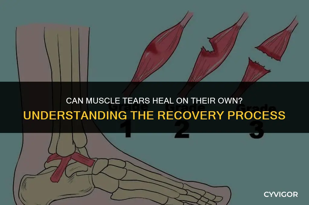 do muscle tars get better on their own