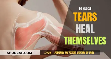 Muscle Tears: Can They Heal Without Intervention?