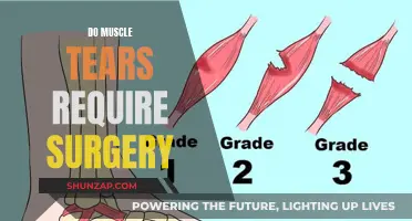 Muscle Tears: When Surgery Is Needed
