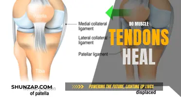 Healing Muscle Tendons: What You Need to Know