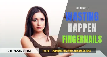 Muscle Wasting and Fingernails: What's the Connection?