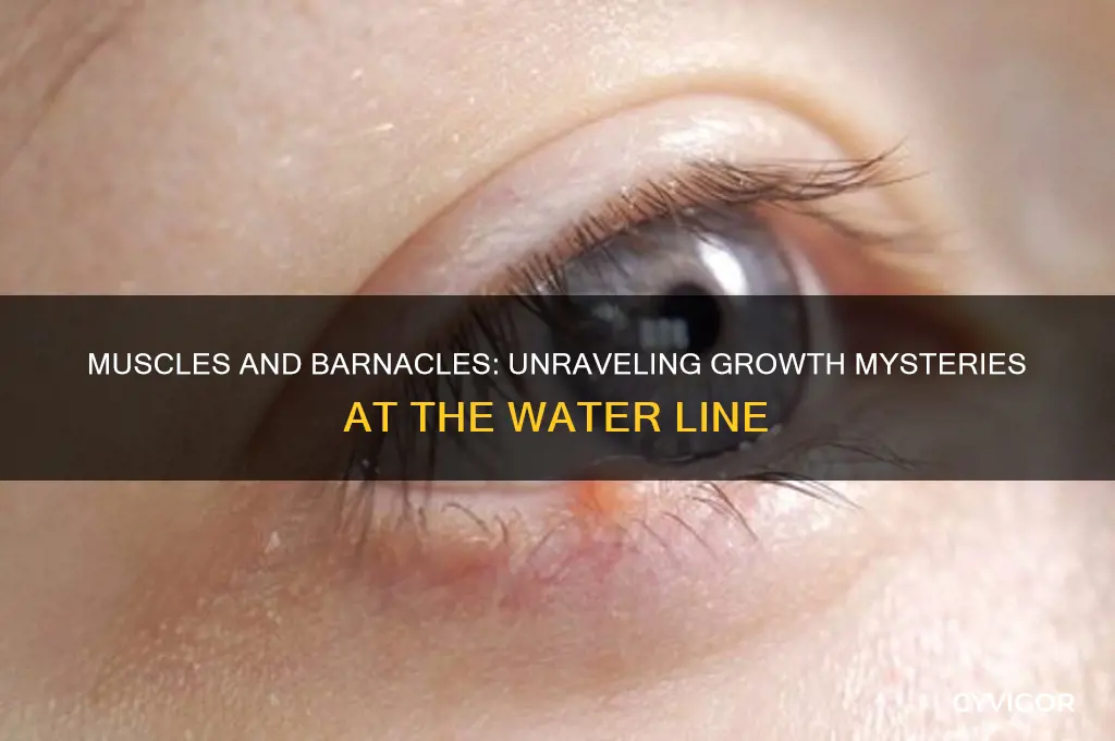 do muscles and barnacles grow at the water line