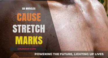 How Muscles Cause Stretch Marks: The Science