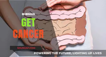 Understanding Muscle Cancer: Facts, Myths, and Prevention Tips
