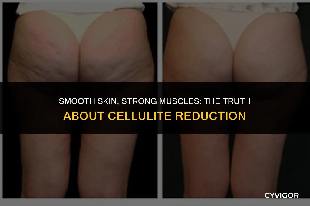do muscles get rid of cellulite