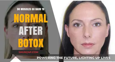 Restoring Natural Muscle Tone Post-Botox: What to Expect