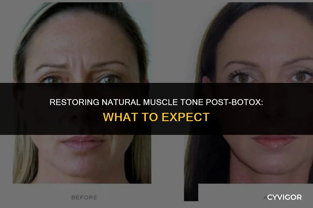 do muscles go back to normal after botox