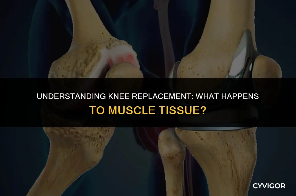 do muscles tissue get cut in knee replacement