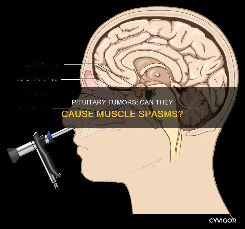do pituitary glad tumors cause muscle spasms