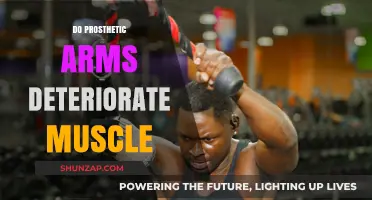 Prosthetic Arms and Muscle Health: Debunking Deterioration Myths