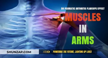 Psoriatic Arthritis Flare-Ups: Impact on Arm Muscles Explained