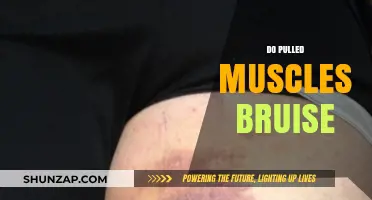 Do Pulled Muscles Cause Bruising? Understanding Muscle Injuries and Symptoms