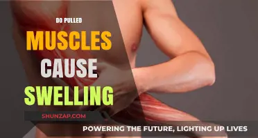 Pulled Muscles: Swelling, Causes, and Treatment