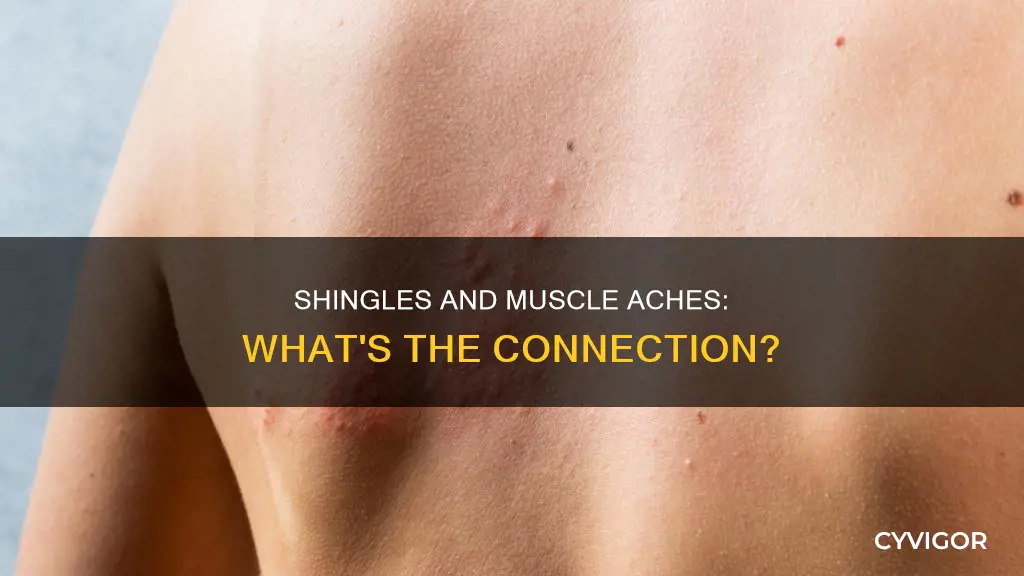 do shingles cause muscle aches