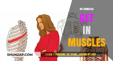 Exploring the Connection: Can Shingles Affect Muscle Tissue?