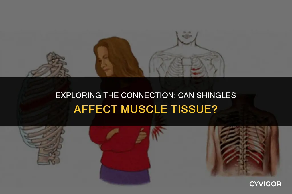 do shingles get in muscles