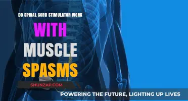 Spinal Cord Stimulators: Effective Relief for Muscle Spasms?
