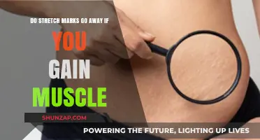 Can Building Muscle Reduce Stretch Marks? The Truth Revealed