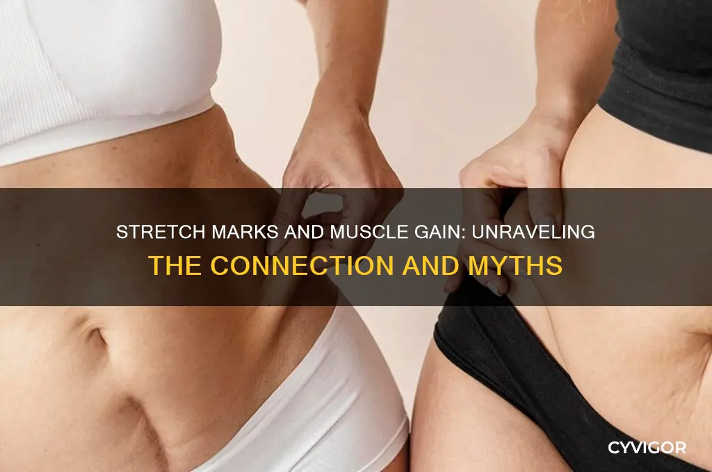 do stretch marks mean i