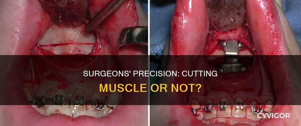do surgeons cut through muscle