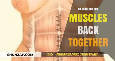 Mending Muscles: The Surgical Art of Restoring Strength and Function